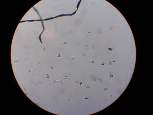 Células de la mucosa de la boca.